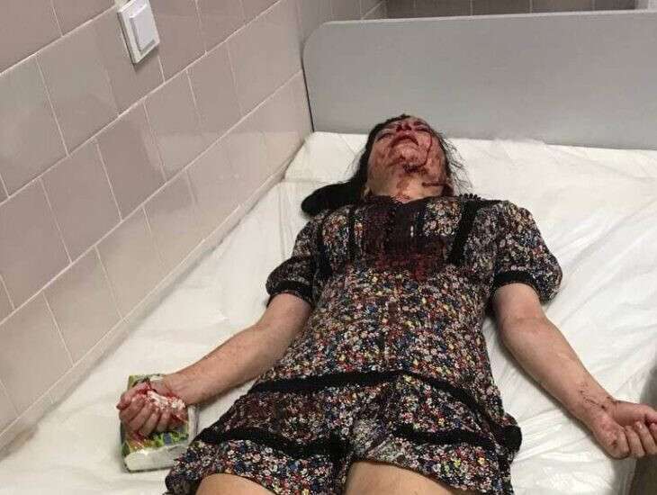 Постраждала